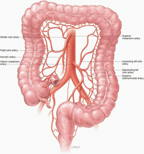 Colon Resection Oncohema Key 8281