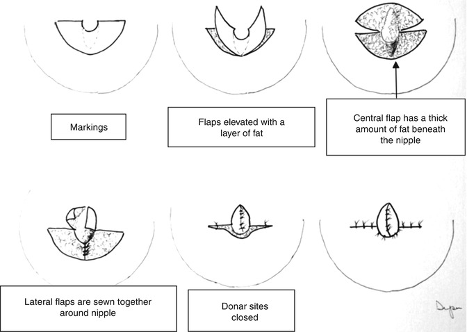 A303957_1_En_21_Fig2_HTML.jpg