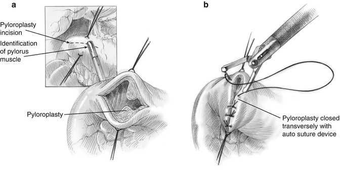 A314799_1_En_11_Fig3_HTML.jpg