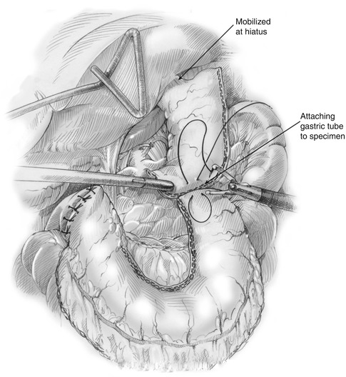 A314799_1_En_11_Fig4_HTML.jpg