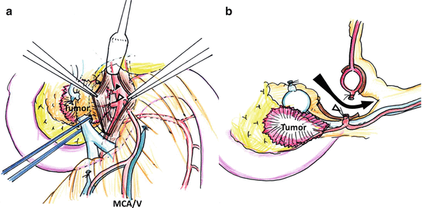 A337590_1_En_19_Fig3_HTML.gif