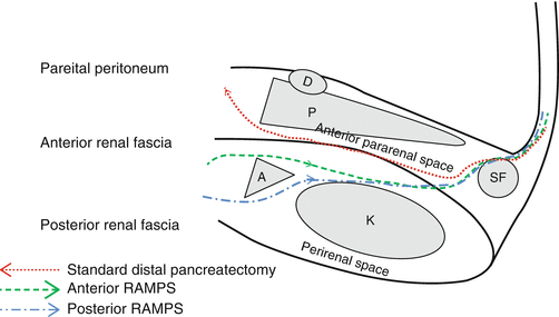 A337590_1_En_25_Fig2_HTML.gif