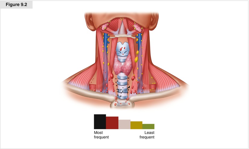 A308028_1_En_9_Fig2_HTML.jpg