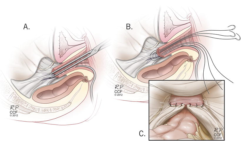 A329286_1_En_13_Fig4_HTML.jpg