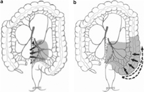 A322063_1_En_11_Fig3_HTML.gif