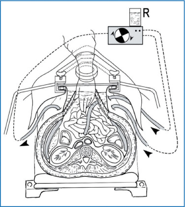 A978-88-470-5711-1_10_Fig2_HTML.jpg