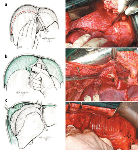 A978-88-470-5711-1_9_Fig6_HTML.jpg