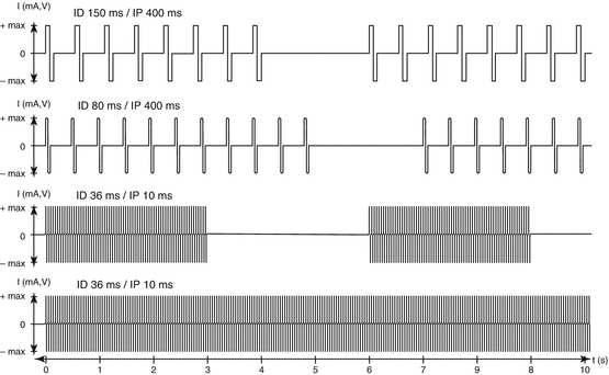 A419206_1_En_11_Fig1_HTML.gif