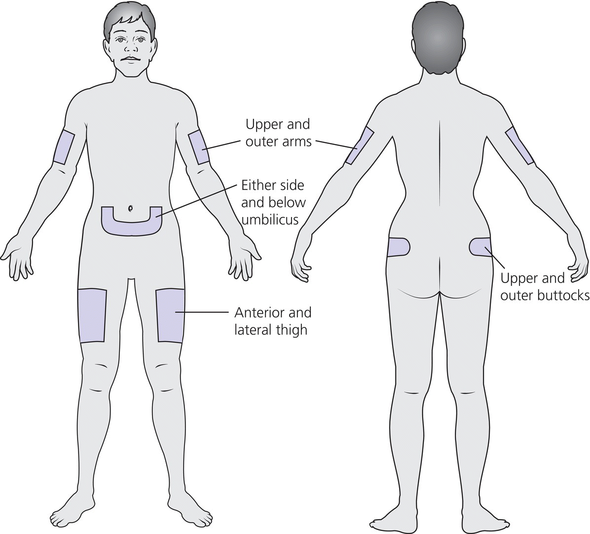 Front and back views of a human body displaying the insulin injection sites such as the upper and outer arms, either side and below umbilicus, anterior and lateral thigh, and upper and outer buttocks.