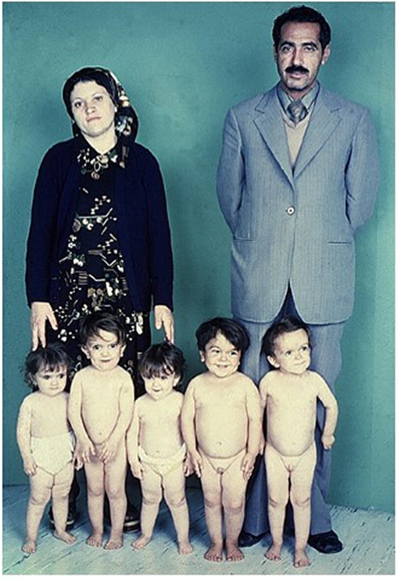 Photo displaying a woman and a man standing at the back of 5 children with GH deficiency.