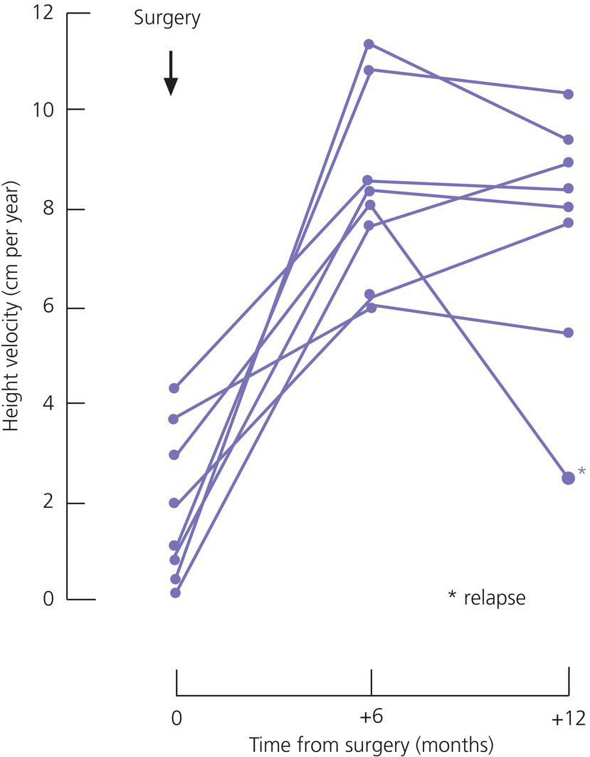 Graph of height velocity vs. time from surgery displaying 8 intersecting curves with closed circle markers. On the upper left portion is a downward arrow labeled surgery. An asterisk is labeled relapse.