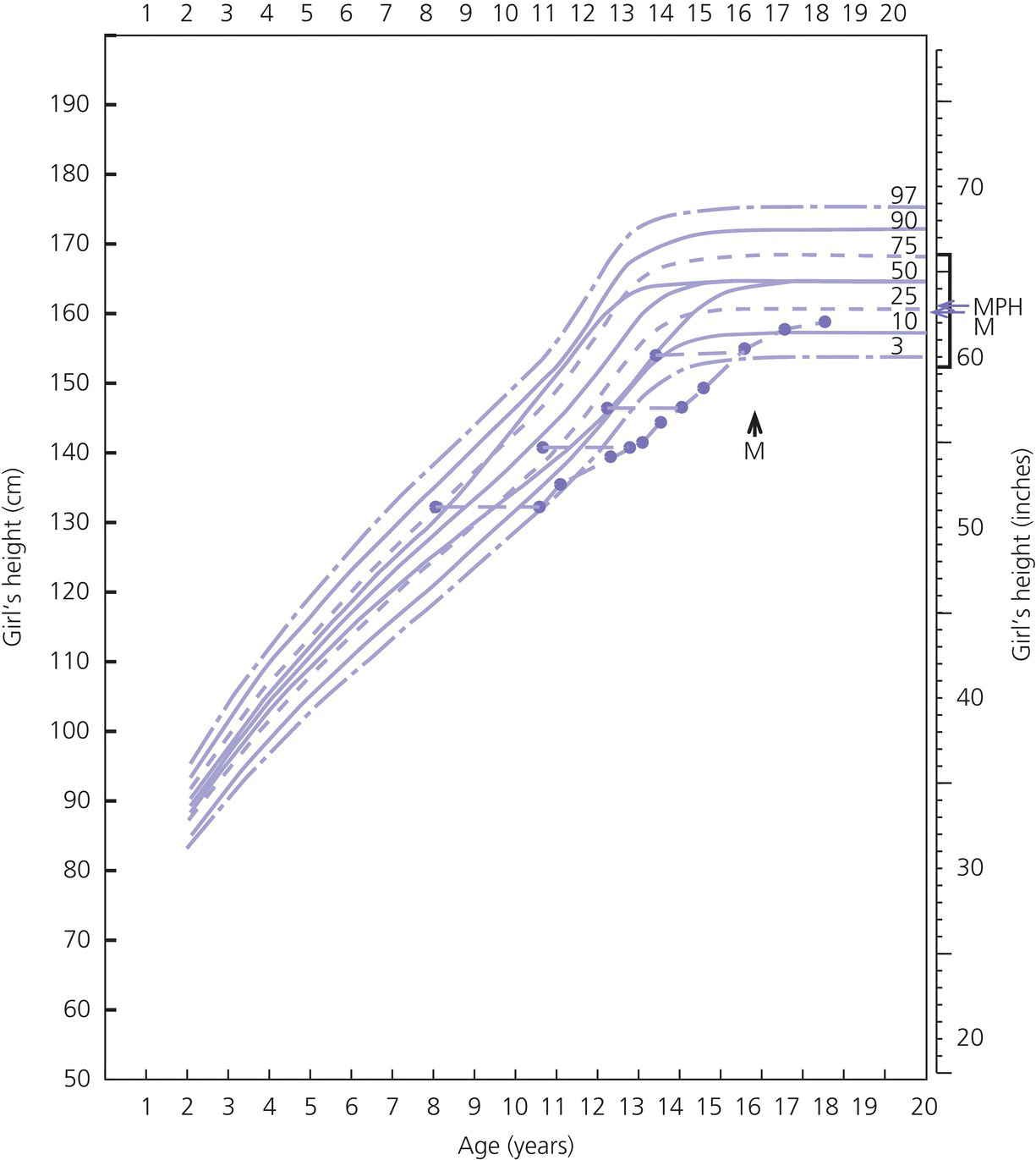 Graph of girl’s height (cm) and girl’s height (inches) vs. age (years) displaying multiple ascending curves with labels 97, 90, 75, 50, 25, 10, and 3. Arrows indicate MPH, M, and M.