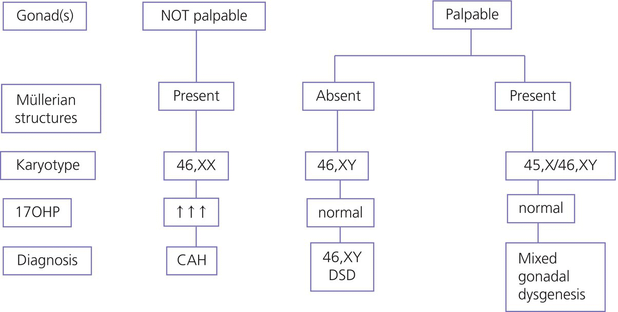 Simplified flow diagram with boxes (left) labeled Gonad (s), Mullerian structures, etc.; 2 flowcharts starting from NOT palpable leading to CAH (middle); and from palpable to 46,XY DSD and mixed gonadal dysgenesis (right).