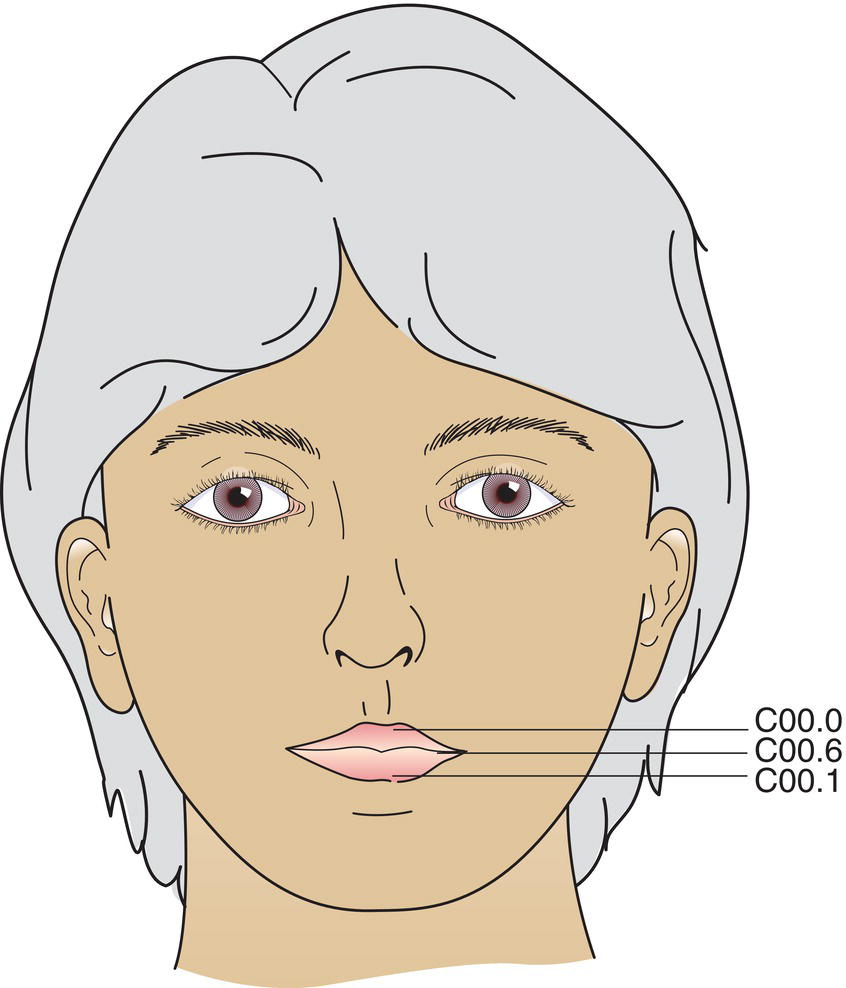 Schematic illustration of External upper lip, External lower lip, and Commissures.