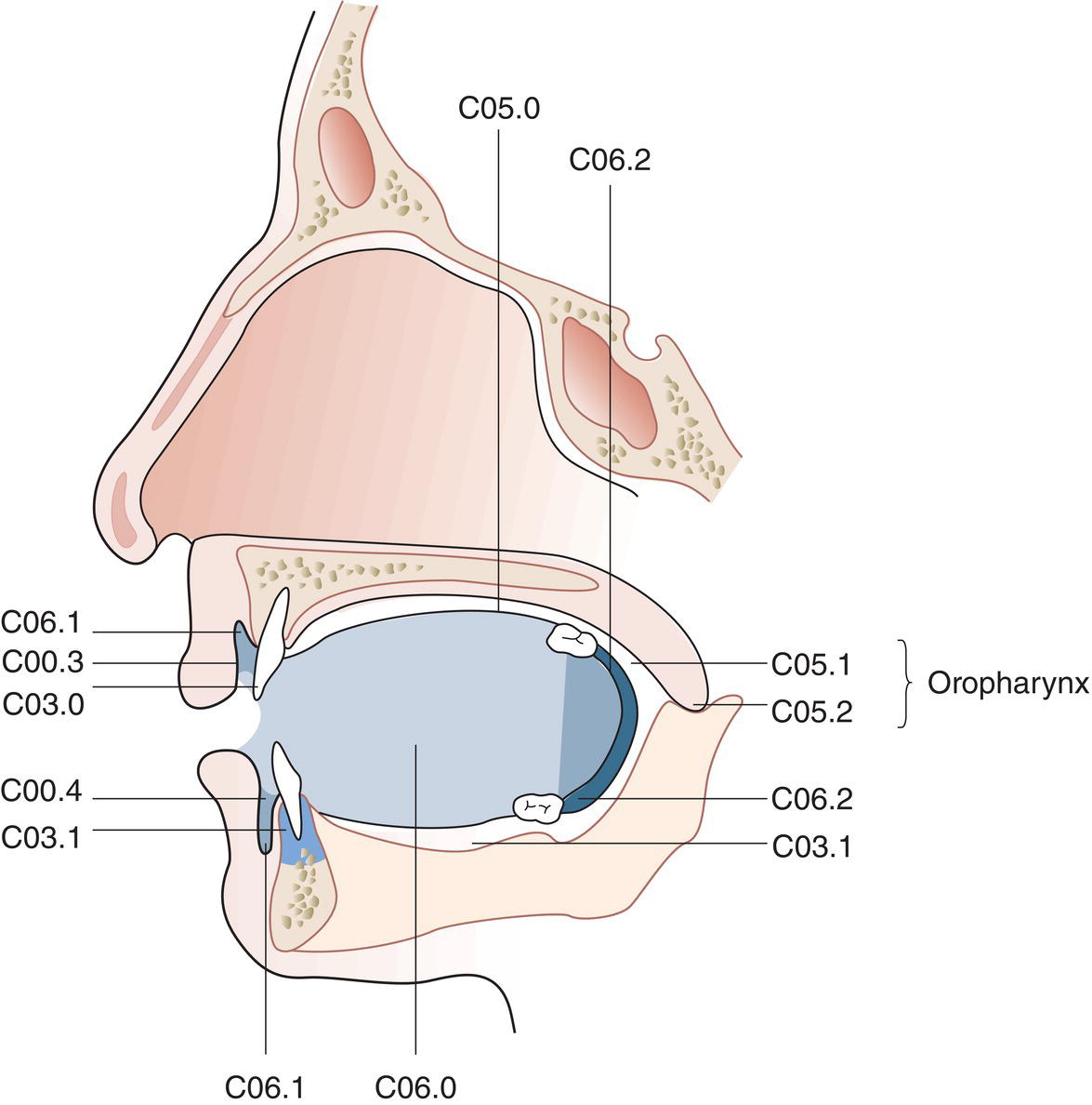 Schematic illustration of the indications of Buccal mucosa, Upper alveolus and gingiva, Lower alveolus and gingiva, Hard palate, and tongue.