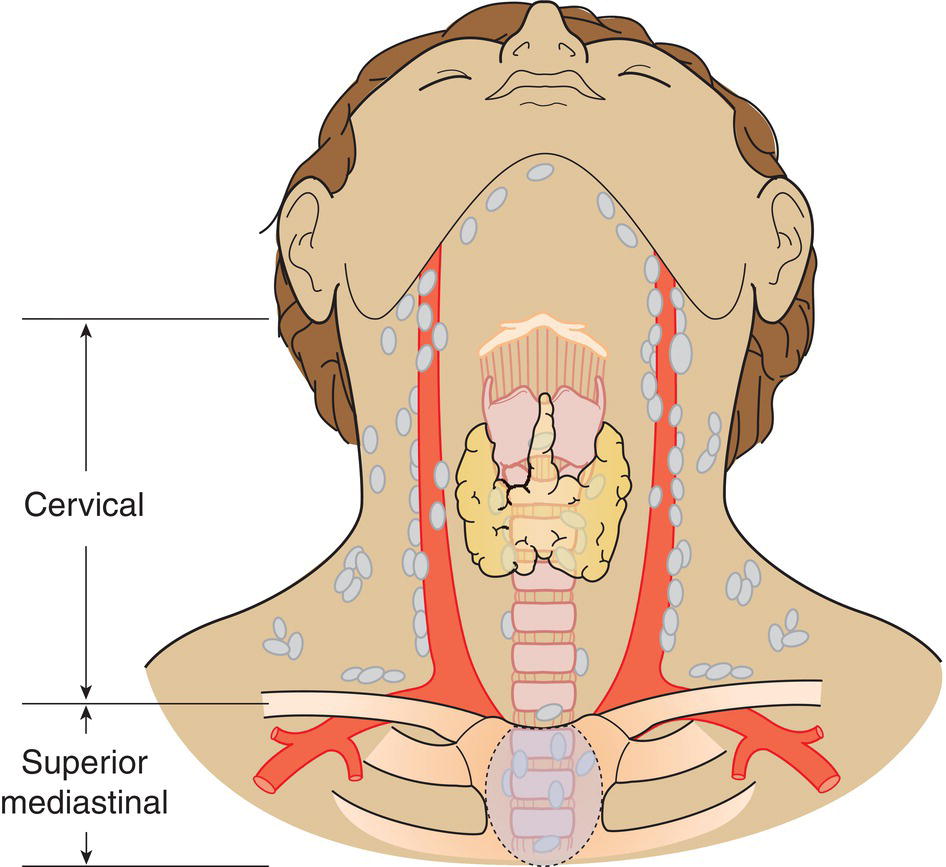 Schematic illustration of Regional Lymph Nodes.