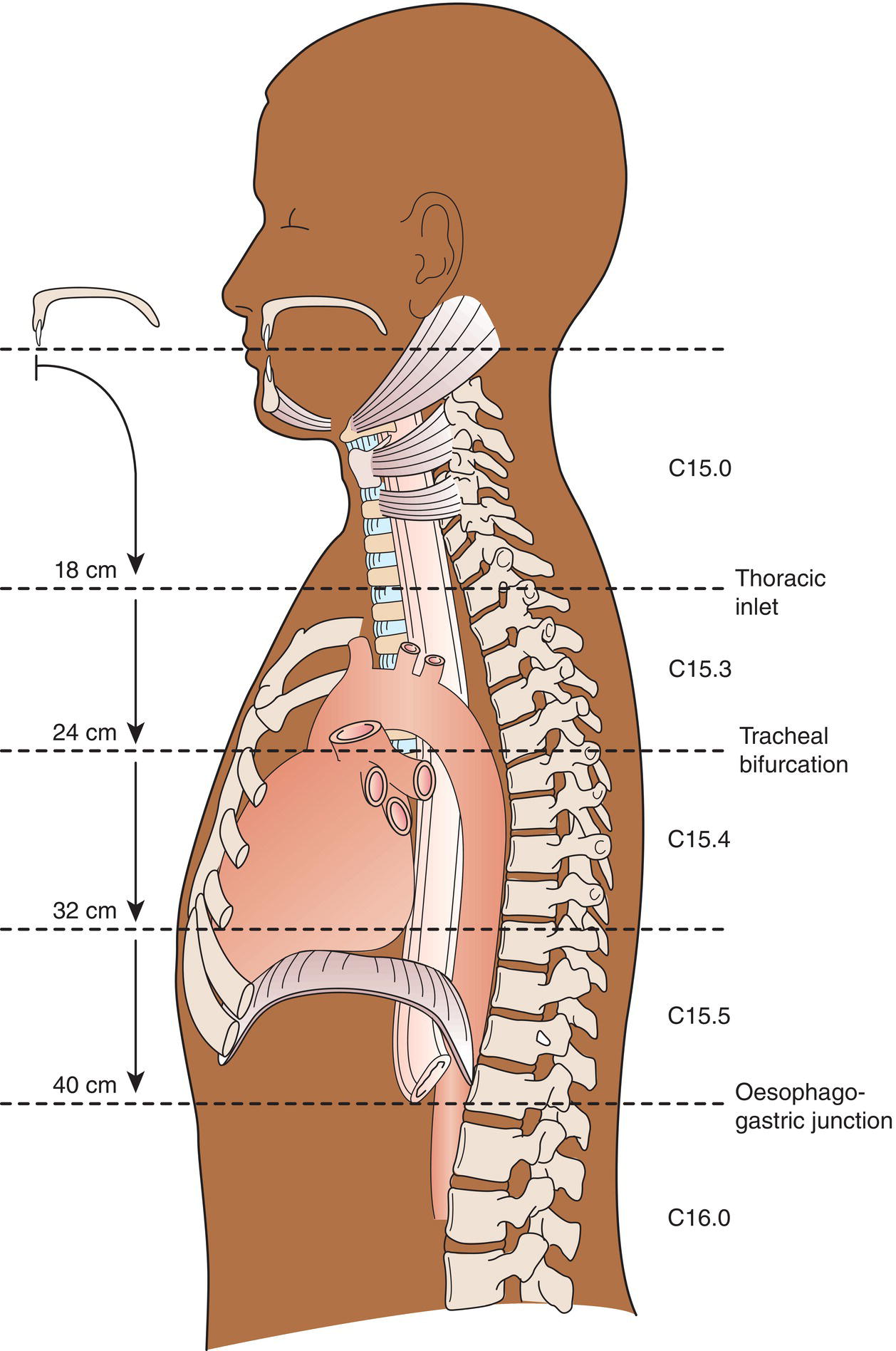 Schematic illustration of Anatomical Subsites.