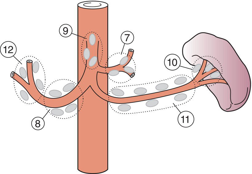 Schematic illustration of Regional Lymph Nodes.