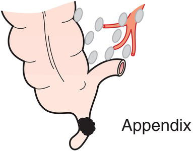 Photo depicts the ileocolic are the regional lymph nodes.