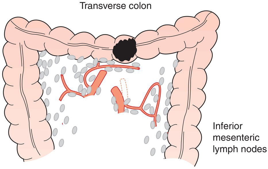 Schematic illustration of Right colic, middle colic, left colic, inferior mesenteric.