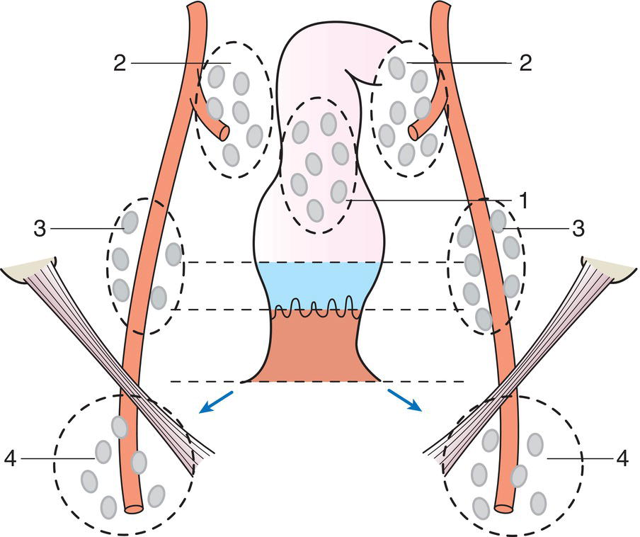 Schematic illustration of Regional Lymph Nodes.