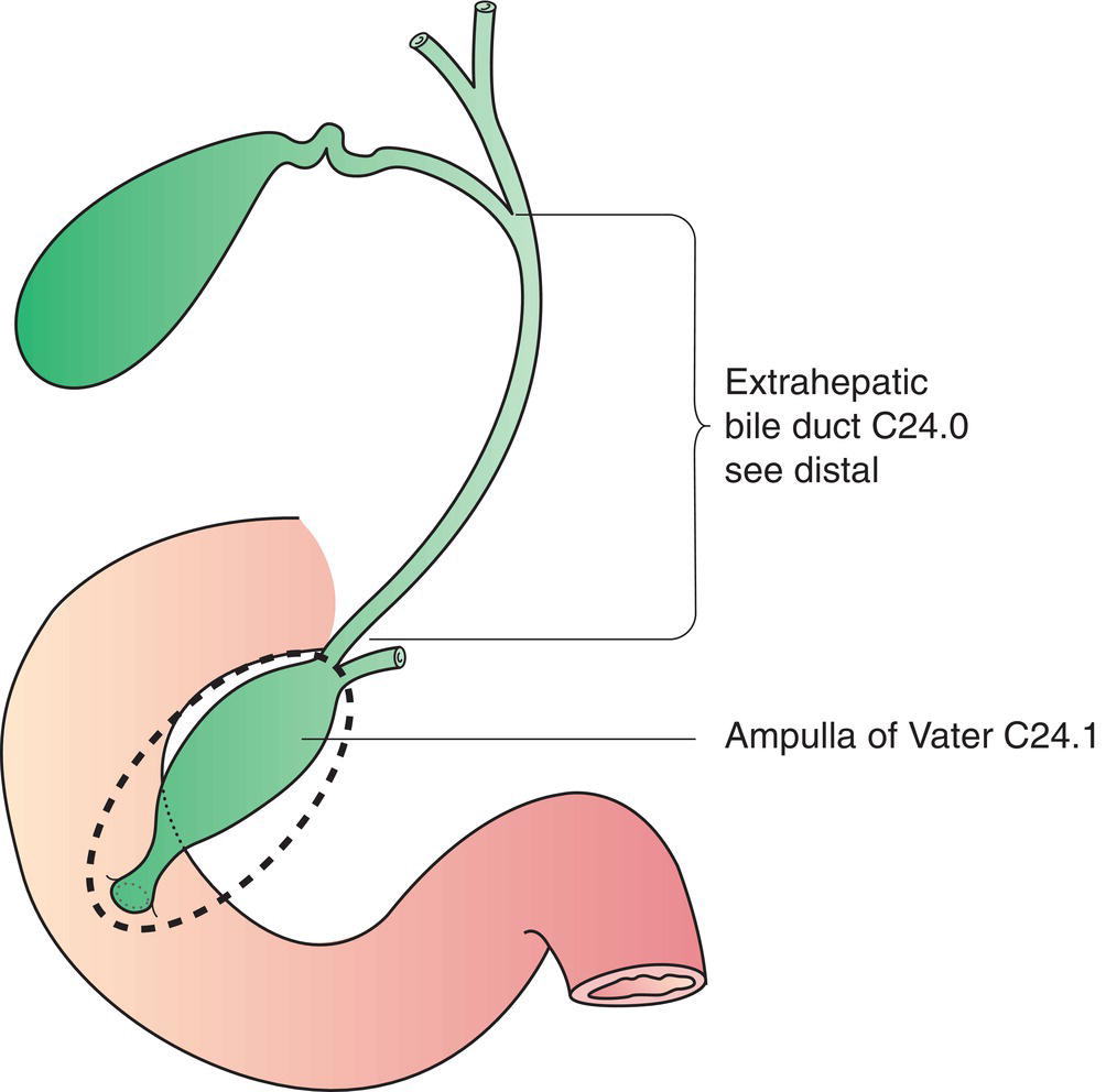 Schematic illustration of ampulla of vater.