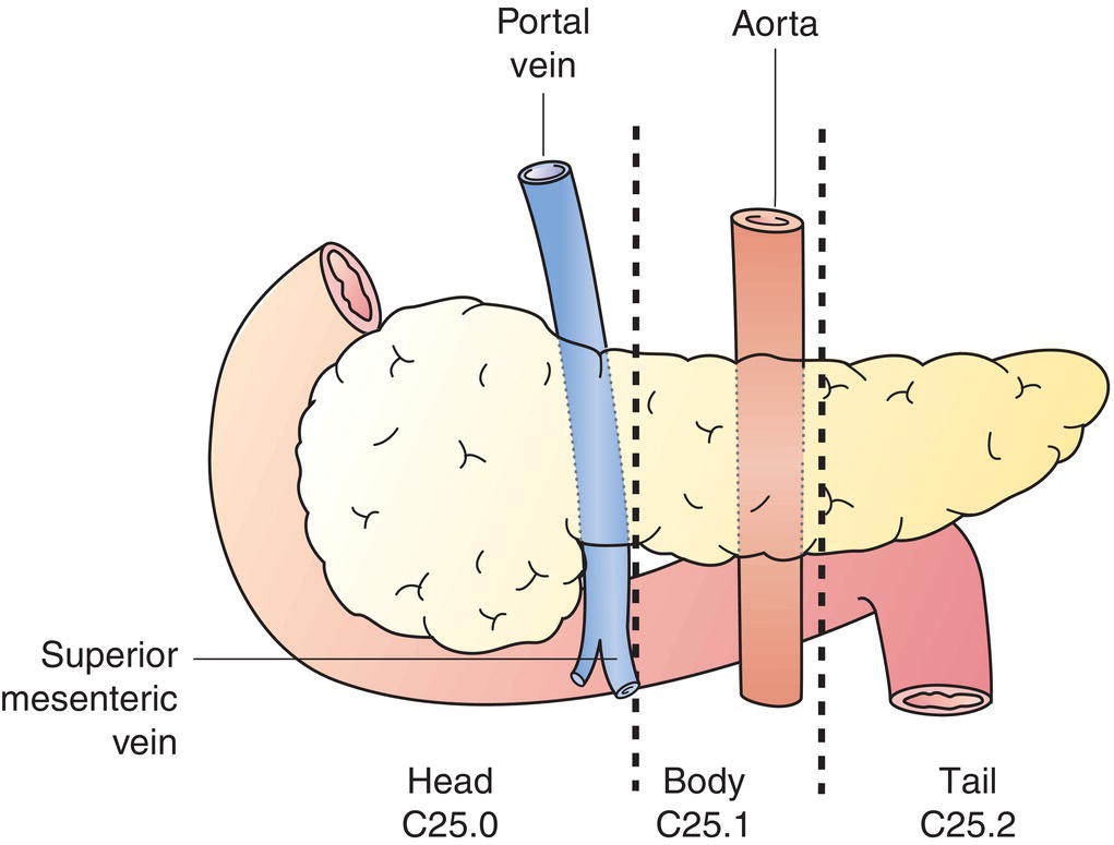 Schematic illustration of Head of pancreas, Body of pancreas and Tail of pancreas.