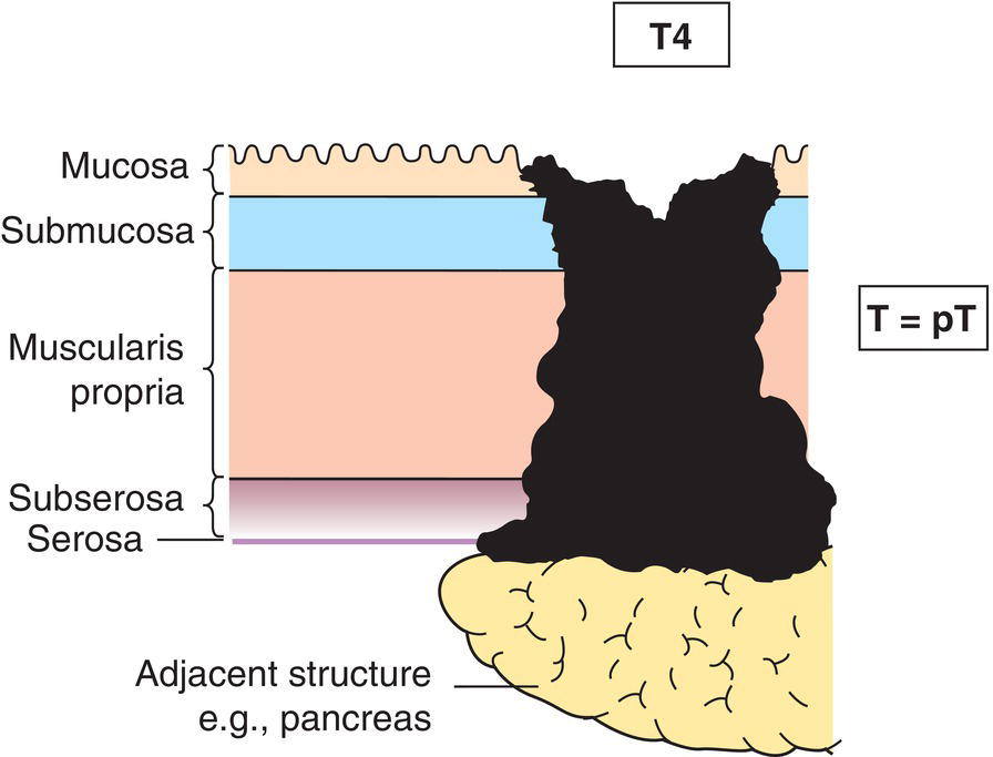 Schematic illustration of other organs or adjacent structures.