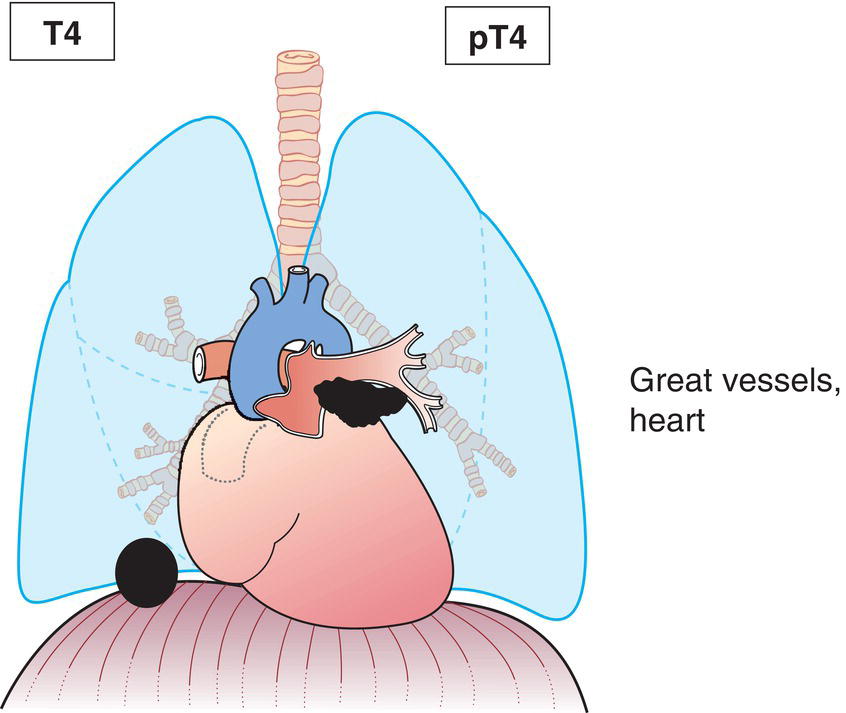 Schematic illustration of diaphragm.