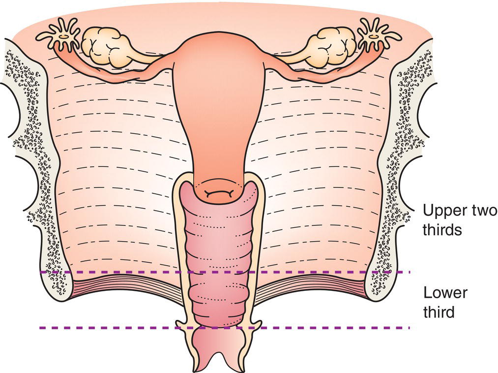 Schematic illustration of Vagina.