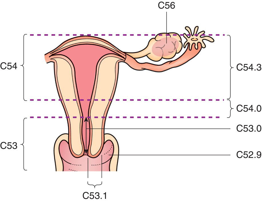 Schematic illustration of Endocervix and Exocervix.