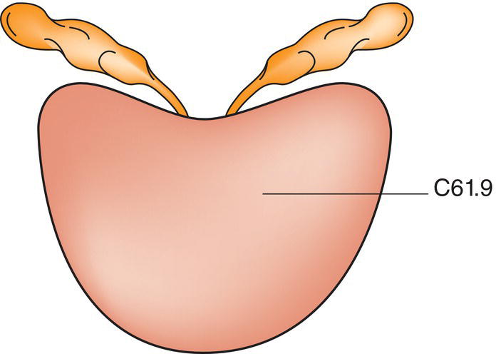 Schematic illustration of Prostate.