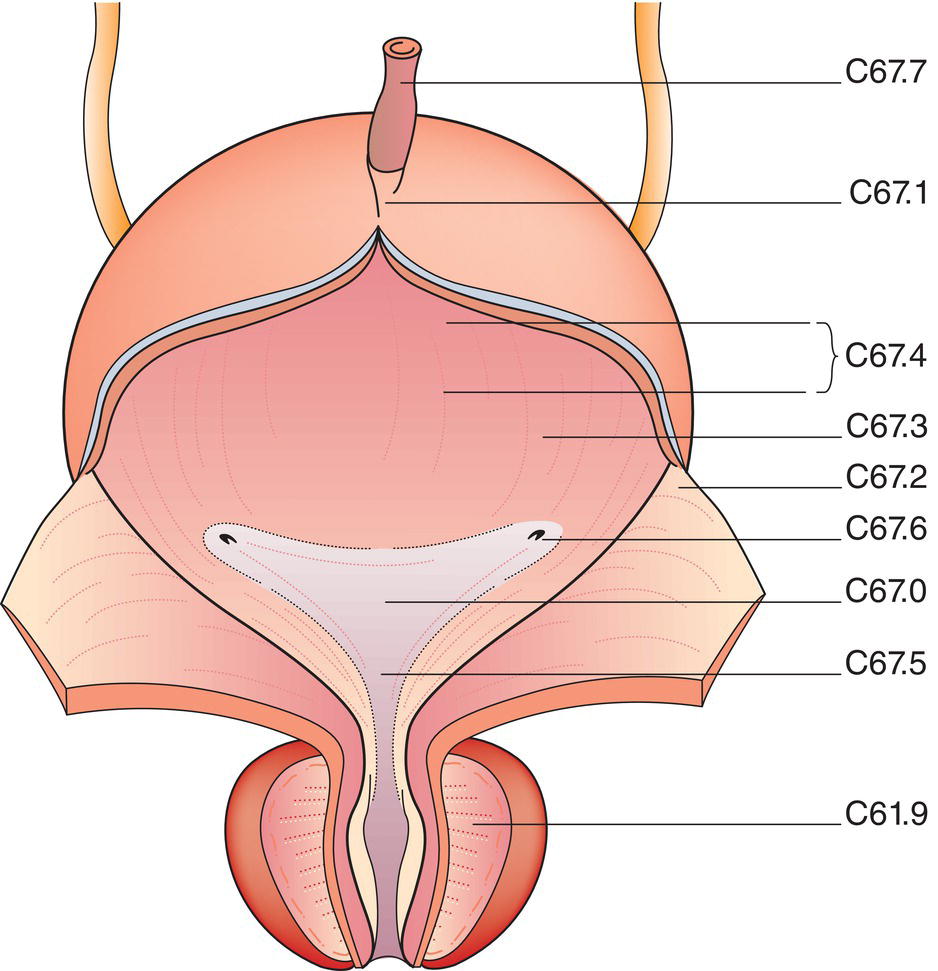 Schematic illustration of Trigone, Dome, Lateral wall, Anterior wall, Posterior wall, Bladder neck, Ureteric orifice, Urachus.