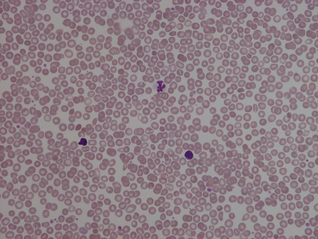 Photo depicts normal blood film at term.