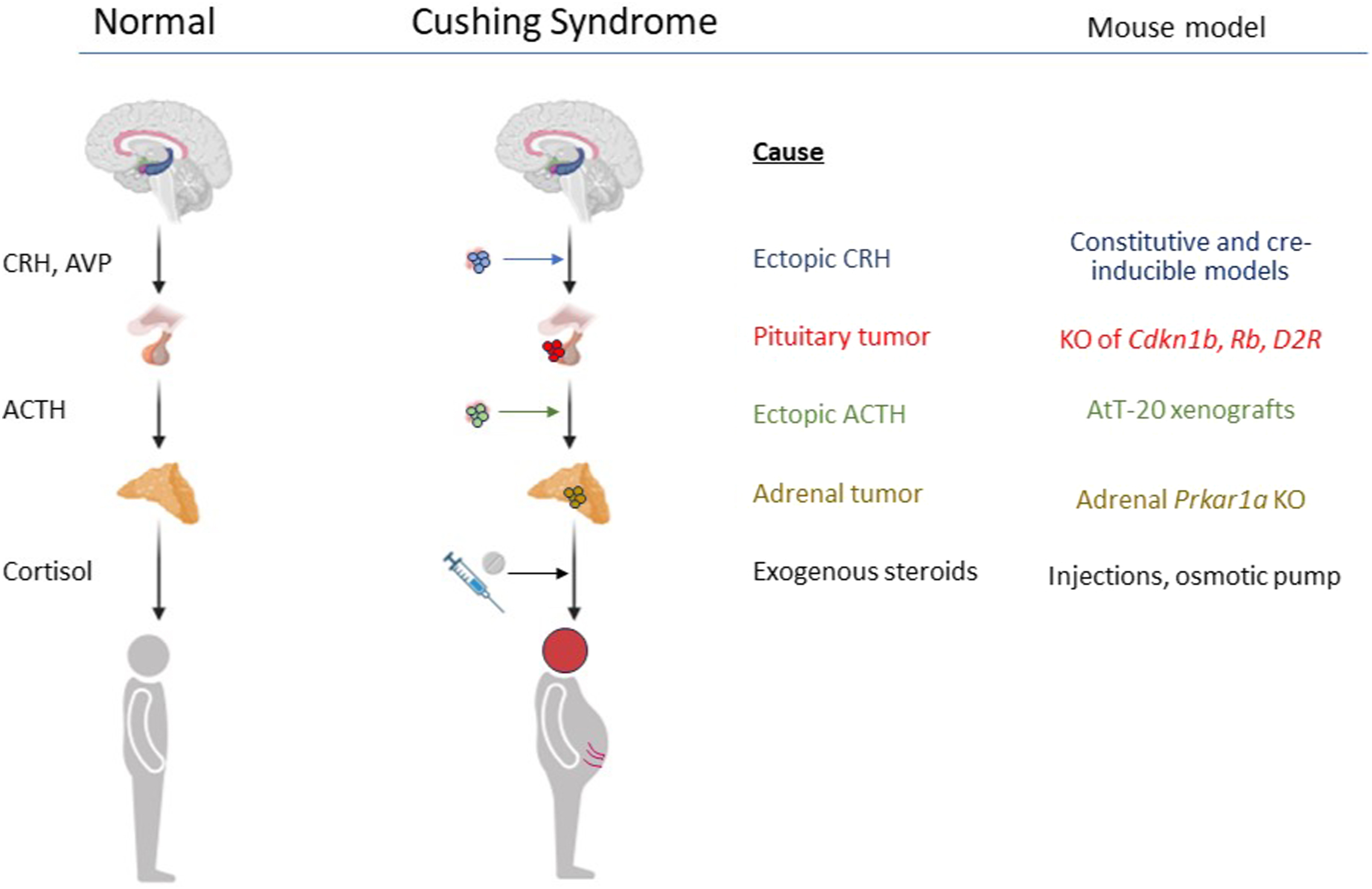 The image is a comparison of normal function of the hypothalamic-pituitary-adrenal (H P A) axis with Cushing syndrome caused by excess cortisol production.