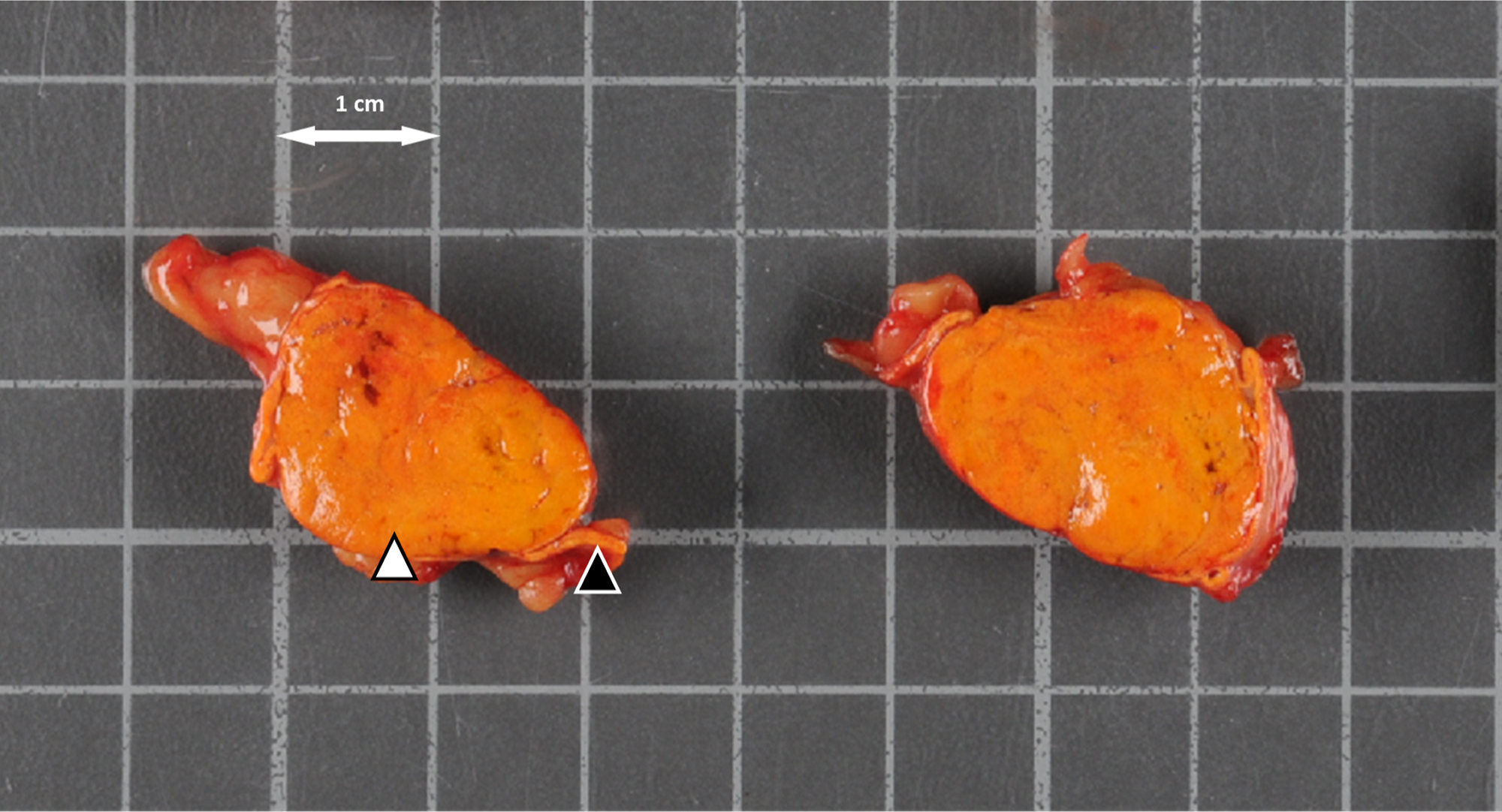 A gross specimen layout with two soft tissue specimens placed left and right on a gridded surface, a 1 centimetre scale arrow above, and two triangular markers near the left specimen.