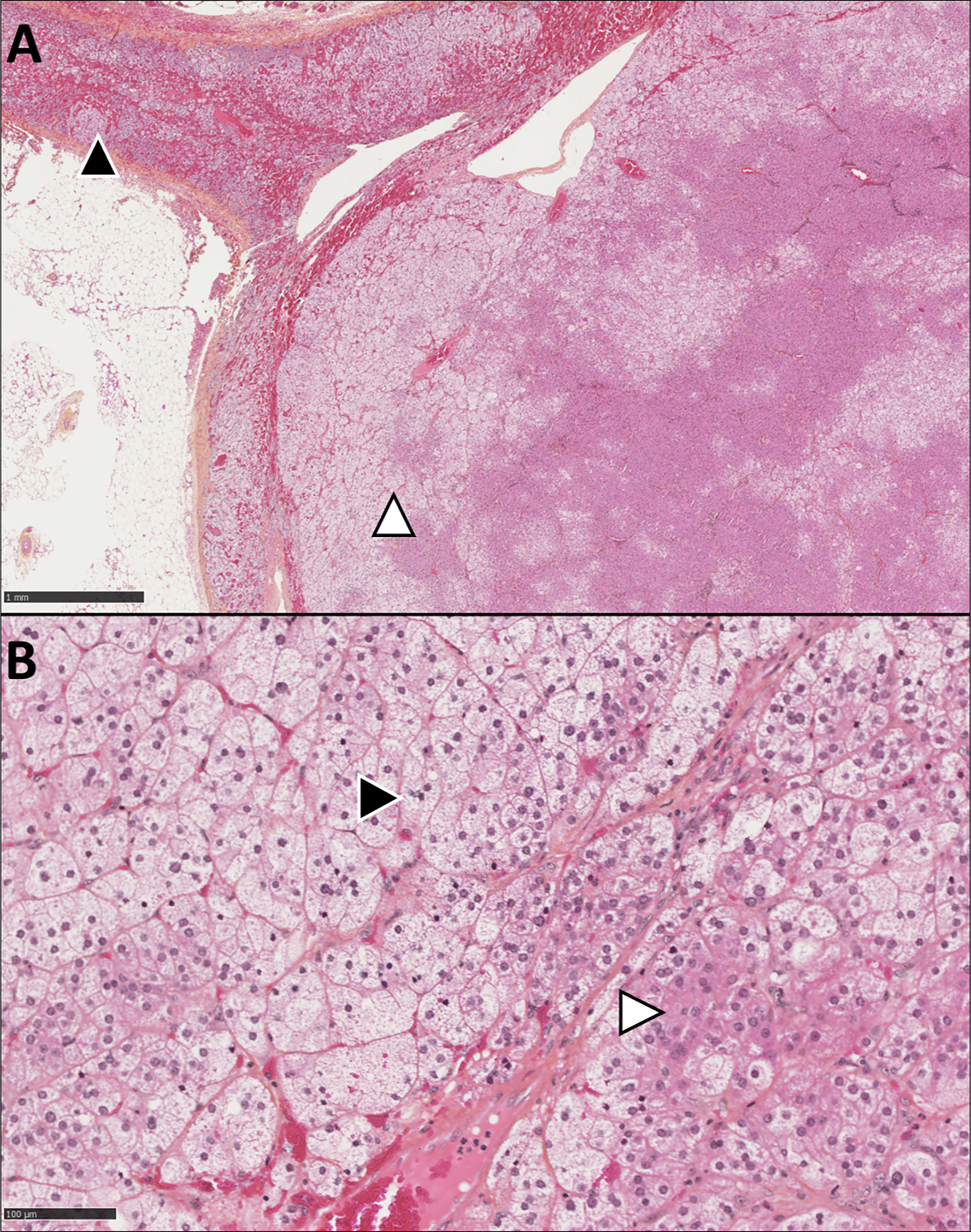 A two panel histological micrograph with panel A tissue, triangular markers, and a 1 millimetre scale bar, and panel B cells, triangular markers, and a 100 micrometres scale bar.
