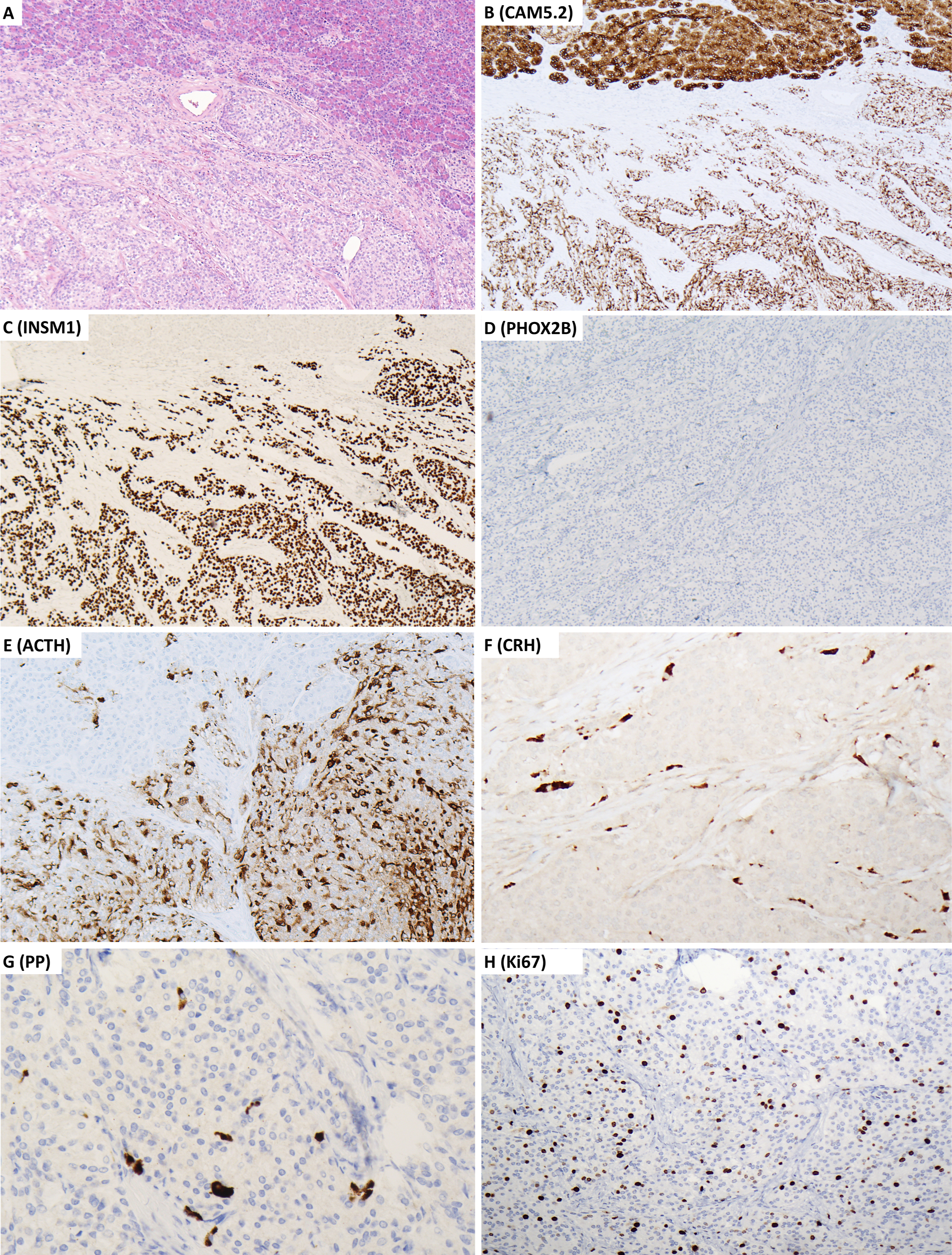 A microscopic visual arranged as 8 labelled panels A to H in a 2 column grid, presenting tissue sections with marker labels C A M 5.2, I N S M 1, P H O X 2 B, A C T H, C R H, P P, and K i 67.