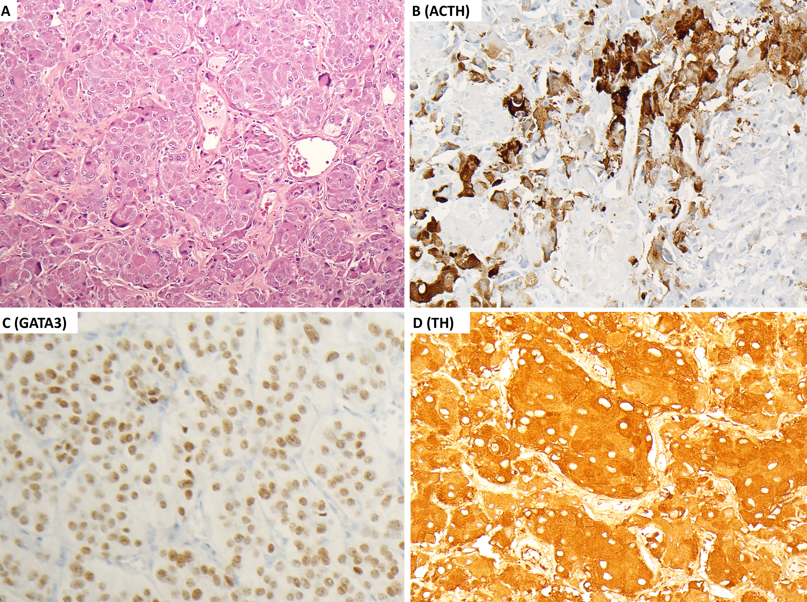 A microscopic visual arranged as 4 labelled panels A to D in a 2 column grid, presenting tissue sections with marker labels A C T H, G A T A 3, and T H.