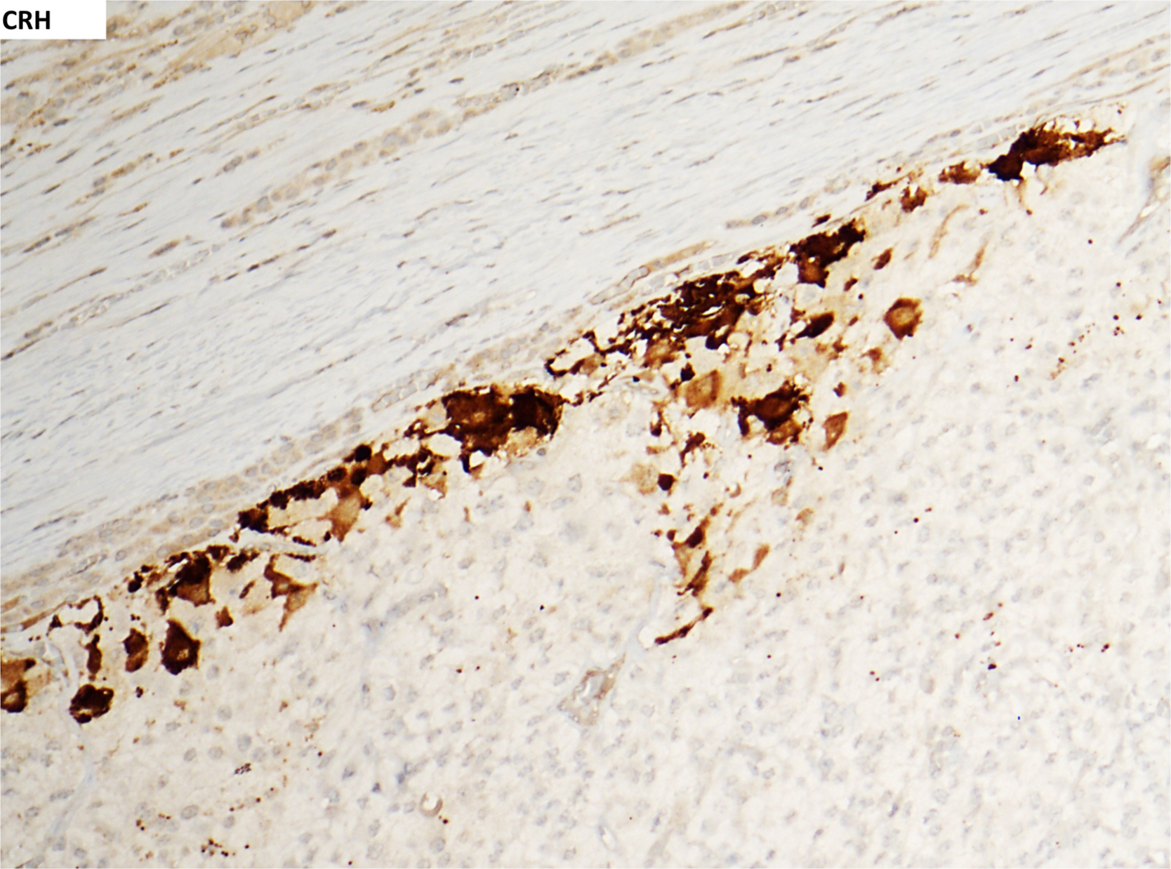 A microscopic visual presenting a single tissue section labelled C R H, with labelled structures forming a diagonal band across the field of view.
