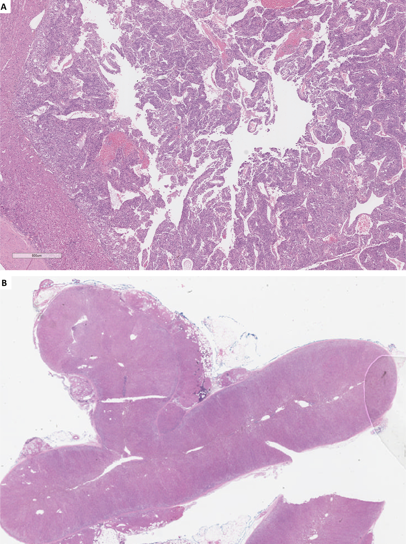 A microscopic visual arranged as 2 labelled panels A and B, presenting low magnification tissue sections and a scale bar labelled 800 micrometres.