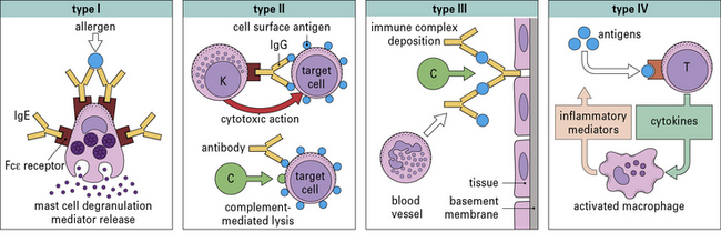 Immediate Hypersensitivity Type I Oncohema Key