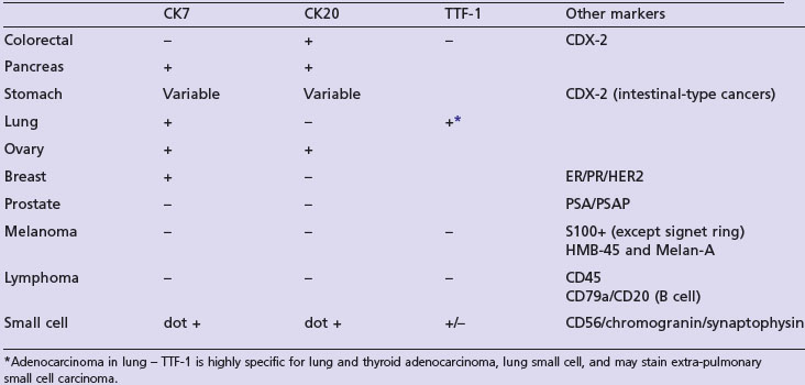 cancer-unknown-primary-cancerconnect