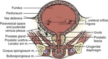 Cancer of the Bladder | Oncohema Key