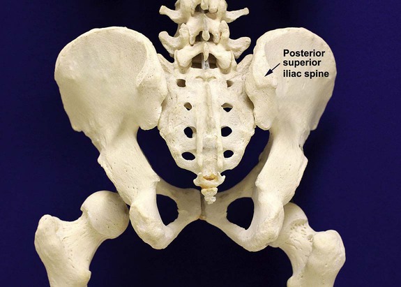 Arthrex - Posterior Iliac Crest Bone Marrow Aspiration - Prone
