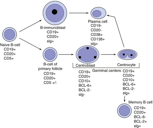 Mature Lymphoid Neoplasms Oncohema Key 