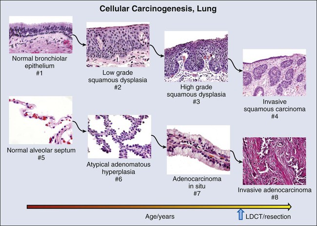 Pathology, Biomarkers, and Molecular Diagnostics | Oncohema Key