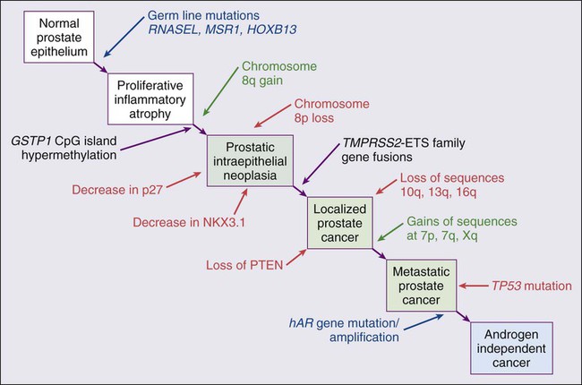 Prostate Cancer Oncohema Key