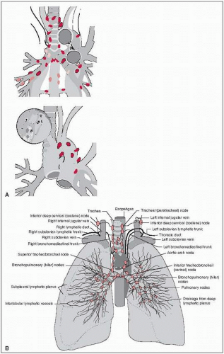 Lung | Oncohema Key