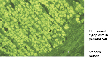 c14-fig-0008